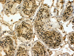 Invitrogen HYD Polyclonal Antibody 100 &mu;g; Unconjugated:Antibodies,
