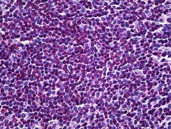 Invitrogen HYD Polyclonal Antibody 100 &mu;g; Unconjugated:Antibodies,