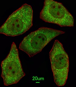 Invitrogen MSRA Polyclonal Antibody 400 &mu;L; Unconjugated:Antibodies,