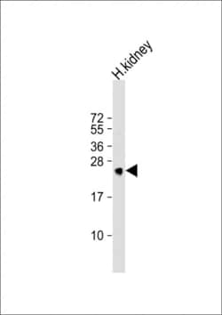 Invitrogen MSRA Polyclonal Antibody 400 &mu;L; Unconjugated:Antibodies,