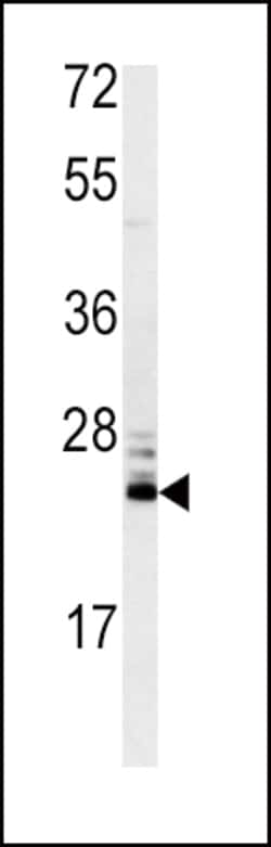 Invitrogen MSRA Polyclonal Antibody 400 &mu;L; Unconjugated:Antibodies,