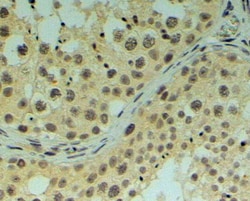 Invitrogen REV1 Polyclonal Antibody 100 &mu;g; Unconjugated:Antibodies,