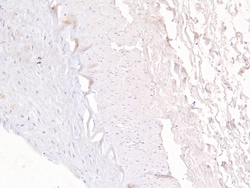 Invitrogen FOXD1 Polyclonal Antibody 100 &mu;g; Unconjugated:Antibodies,