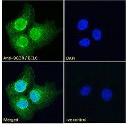 Invitrogen BCOR Polyclonal Antibody 100 μg; Unconjugated:Antibodies,