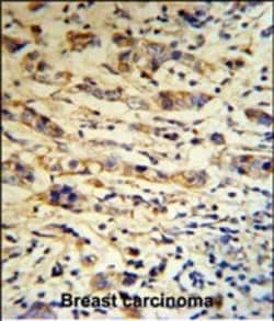 Invitrogen A1BG Polyclonal Antibody 400 &mu;L | Buy Online | Invitrogen&trade; | Fisher Scientific