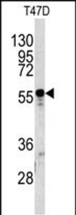 Invitrogen A1BG Polyclonal Antibody 400 &mu;L | Buy Online | Invitrogen&trade; | Fisher Scientific