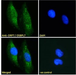 Invitrogen ORP7 Polyclonal Antibody 100 &mu;g; Unconjugated:Antibodies,