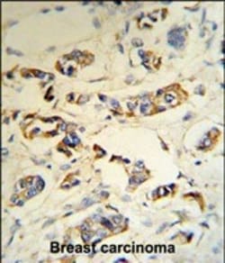 Invitrogen C1QA Polyclonal Antibody 400 &mu;L; Unconjugated:Antibodies,