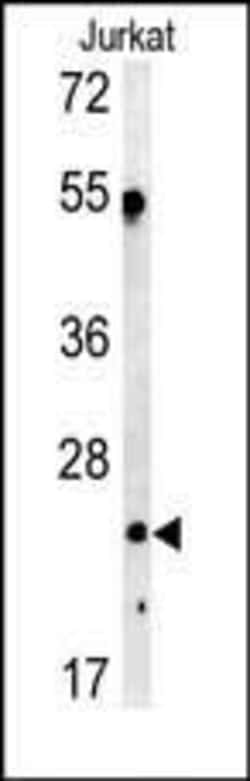 Invitrogen C1QA Polyclonal Antibody 400 &mu;L; Unconjugated:Antibodies,