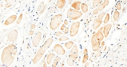 Invitrogen BTRC Polyclonal Antibody 100 &mu;g; Unconjugated:Antibodies,