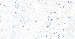 Invitrogen BTRC Polyclonal Antibody 100 &mu;g; Unconjugated:Antibodies,