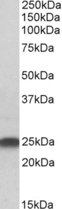 Invitrogen LIN7B Polyclonal Antibody 100 &mu;g; Unconjugated:Antibodies,