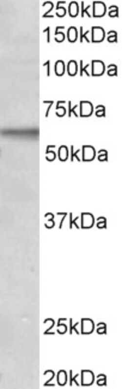 Invitrogen ACVRL1 Polyclonal Antibody 100 μg; Unconjugated:Antibodies,