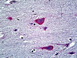 Invitrogen EDF1 Polyclonal Antibody 100 &mu;g; Unconjugated:Antibodies,