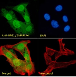 Invitrogen BRG1 Polyclonal Antibody 100 &mu;g; Unconjugated:Antibodies,