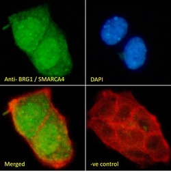 Invitrogen BRG1 Polyclonal Antibody 100 &mu;g; Unconjugated:Antibodies,