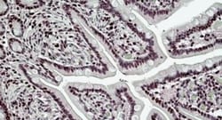 Invitrogen BRG1 Polyclonal Antibody 100 &mu;g; Unconjugated:Antibodies,