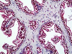Invitrogen BRG1 Polyclonal Antibody 100 &mu;g; Unconjugated:Antibodies,
