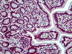 Invitrogen BRG1 Polyclonal Antibody 100 &mu;g; Unconjugated:Antibodies,