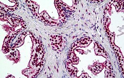 Invitrogen BRG1 Polyclonal Antibody 100 &mu;g; Unconjugated:Antibodies,