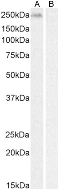 Invitrogen BRG1 Polyclonal Antibody 100 &mu;g; Unconjugated:Antibodies,