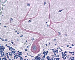 Invitrogen MRCK alpha Polyclonal Antibody 100 &mu;g | Buy Online | Invitrogen&trade; | Fisher Scientific