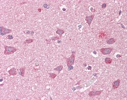 Invitrogen GRASP1 Polyclonal Antibody 100 &mu;g; Unconjugated:Antibodies,