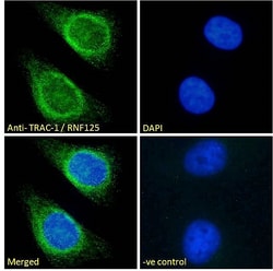 Invitrogen TRAC-1 Polyclonal Antibody 100 &mu;g; Unconjugated:Antibodies,