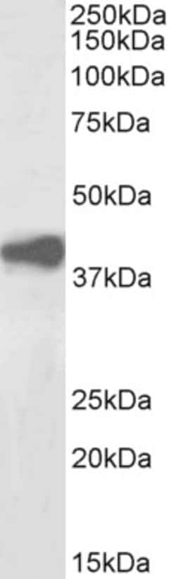 Invitrogen ADH1A/ADH1B/ADH1C Polyclonal Antibody, Biotin 100 &mu;g; Biotin:Antibodies,