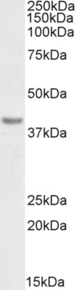 Invitrogen PD-L1 (CD274) Polyclonal Antibody, Biotin 100 &mu;g; Biotin:Antibodies,