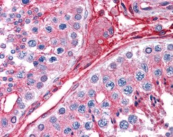 Invitrogen CYBRD1 Polyclonal Antibody 100 &mu;g; Unconjugated:Antibodies,