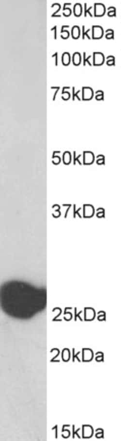 Invitrogen TPI1 Polyclonal Antibody, Biotin 100 &mu;g; Biotin:Antibodies,