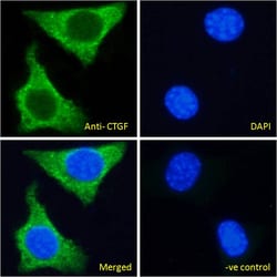 Invitrogen CTGF Polyclonal Antibody 100 &mu;g; Unconjugated:Antibodies,