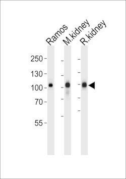 Invitrogen CD10 Polyclonal Antibody 400 &mu;L; Unconjugated:Antibodies,