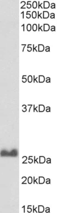 Invitrogen SNAP25 Polyclonal Antibody, Biotin 100 &mu;g; Biotin:Antibodies,