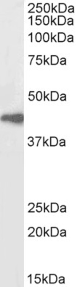 Invitrogen beta-Arrestin 2 Polyclonal Antibody, Biotin 100 &mu;g | Buy Online | Invitrogen&trade; | Fisher Scientific