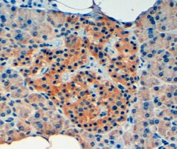 Invitrogen VPS11 Polyclonal Antibody 100 &mu;g; Unconjugated:Antibodies,