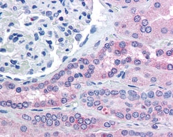 Invitrogen RHPN2 Polyclonal Antibody 100 &mu;g; Unconjugated:Antibodies,