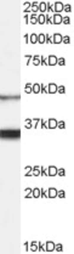 Invitrogen Orexin Receptor 1 Polyclonal Antibody 100 &mu;g; Unconjugated:Antibodies,