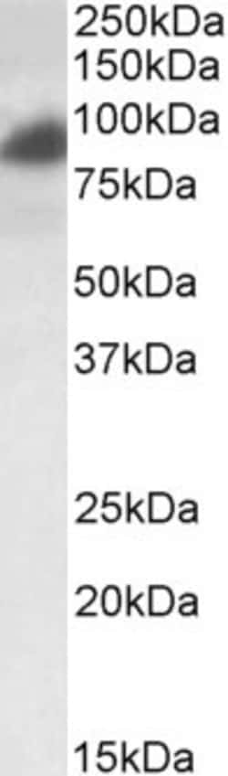 Invitrogen™ RAB11FIP1 Polyclonal Antibody