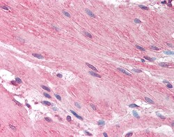 Invitrogen HRH1 Polyclonal Antibody 100 &mu;g; Unconjugated:Antibodies,