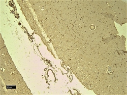 Invitrogen SCN5A Polyclonal Antibody 100 μg; Unconjugated:Antibodies,