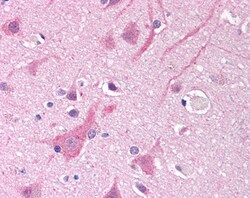 Invitrogen SCN5A Polyclonal Antibody 100 μg; Unconjugated:Antibodies,