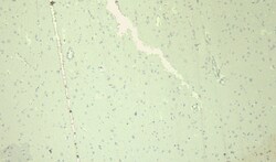 Invitrogen SCN5A Polyclonal Antibody 100 μg; Unconjugated:Antibodies,