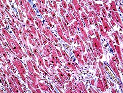 Invitrogen TIN2 Polyclonal Antibody 100 μg; Unconjugated:Antibodies,