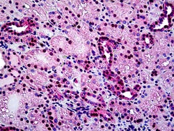 Invitrogen TIN2 Polyclonal Antibody 100 μg; Unconjugated:Antibodies,