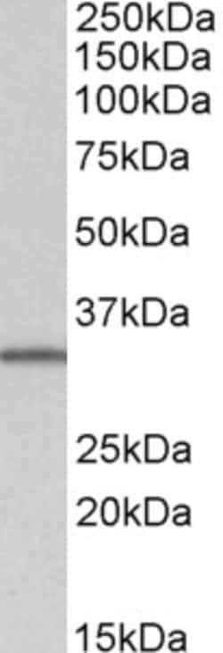 Invitrogen NHERF2 (Isoform B/E) Polyclonal Antibody 100 &mu;g; Unconjugated:Antibodies,