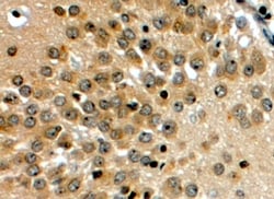 Invitrogen NOTCH3 Polyclonal Antibody 100 &mu;g; Unconjugated:Antibodies,