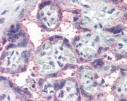 Invitrogen NOTCH3 Polyclonal Antibody 100 &mu;g; Unconjugated:Antibodies,