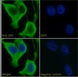 Invitrogen SHH Polyclonal Antibody 100 &mu;g; Unconjugated:Antibodies,